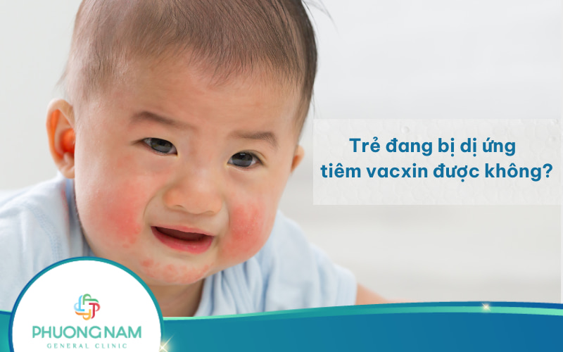 Trẻ đang bị dị ứng có tiêm vacxin được không? Lưu ý khi tiêm ngừa cho bé!