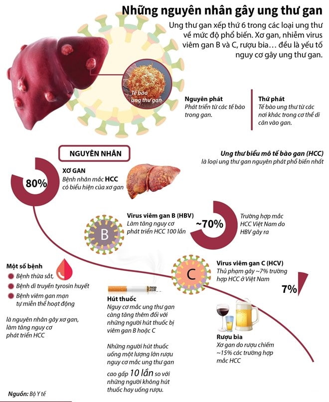 Các nguyên nhân có thể dẫn đến xơ gan gây ung thư hóa bao gồm xơ gan do rượu, xơ gan thứ phát do nhiễm virus viêm gan B, virus viêm gan C 