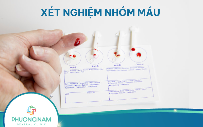 Ý nghĩa của xét nghiệm nhóm máu và một số lưu ý khi xét nghiệm máu