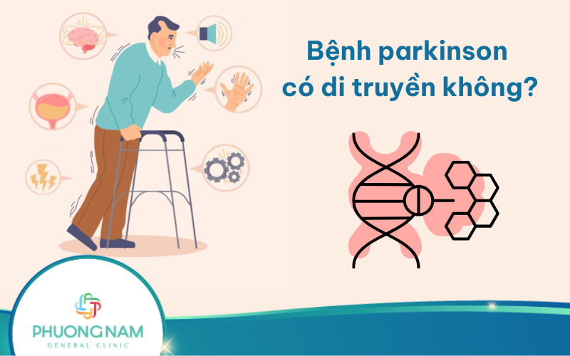 Bệnh parkinson có di truyền không? Nguyên nhân & cách phòng ngừa bệnh!