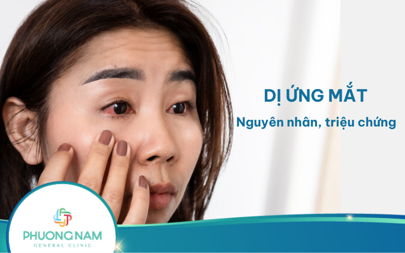 Dị ứng mắt: Nguyên nhân, triệu chứng và biện pháp phòng ngừa