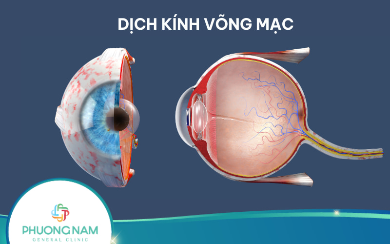 Dịch kính võng mạc: Chức năng, vị trí, giải phẫu cấu tạo