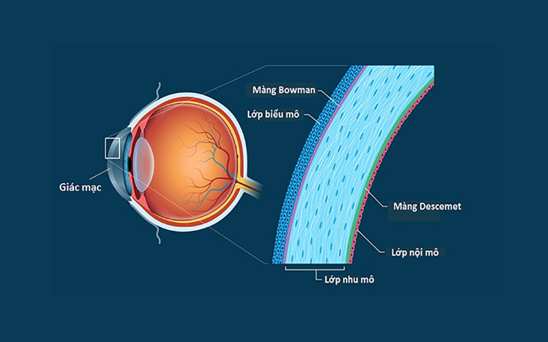 Hình ảnh cấu tạo giác mạc