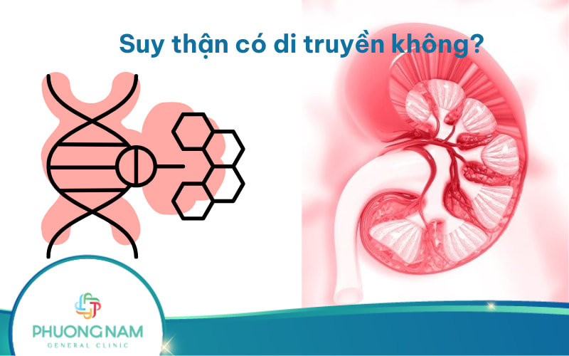 Bệnh thận có di truyền không? Và các loại bệnh thận di truyền!