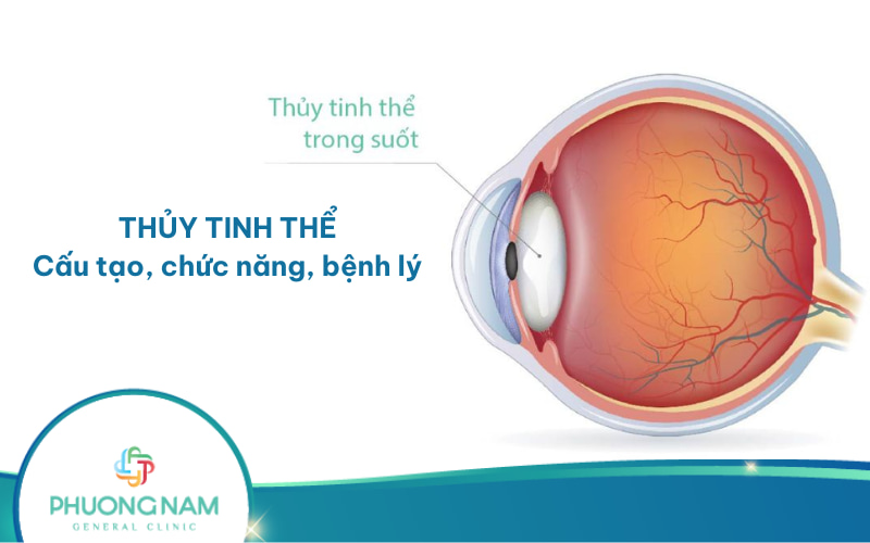 Thủy tinh thể: Cấu tạo, nguyên nhân, triệu chứng và phân loại