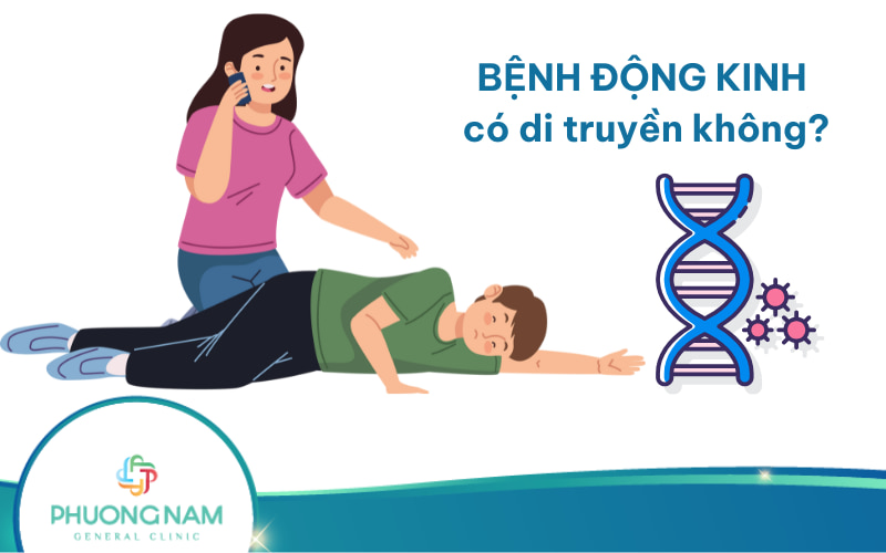 Bệnh động kinh có di truyền không? Nhận biết bệnh ở trẻ