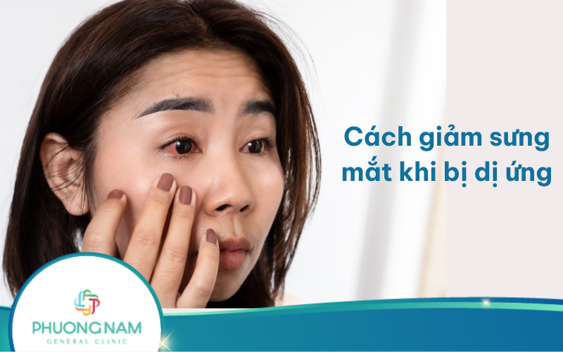 Cách làm giảm sưng mắt khi bị dị ứng