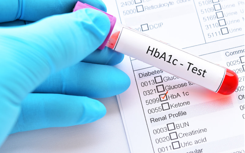 Xét nghiệm Hemoglobin A1c (HbA1c)