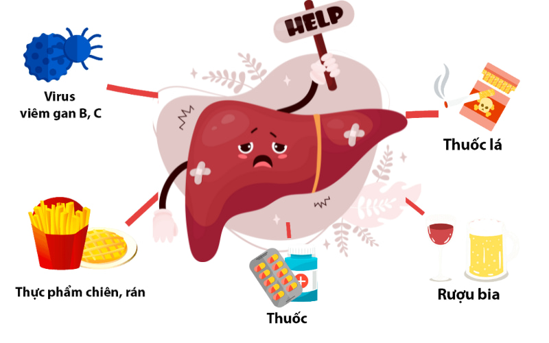 Những nguyên nhân khiến chỉ số GGT tăng cao