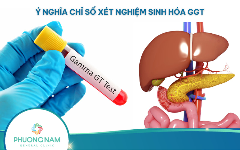 Chỉ số GGT là gì? Ý nghĩa của chỉ số xét nghiệm sinh hoá GGT