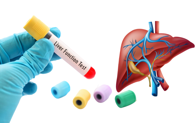 Tùy thuộc vào tình trạng sức khỏe và nghi ngờ bệnh lý, bác sĩ sẽ lựa chọn các xét nghiệm phù hợp để đánh giá chức năng gan của bạn.