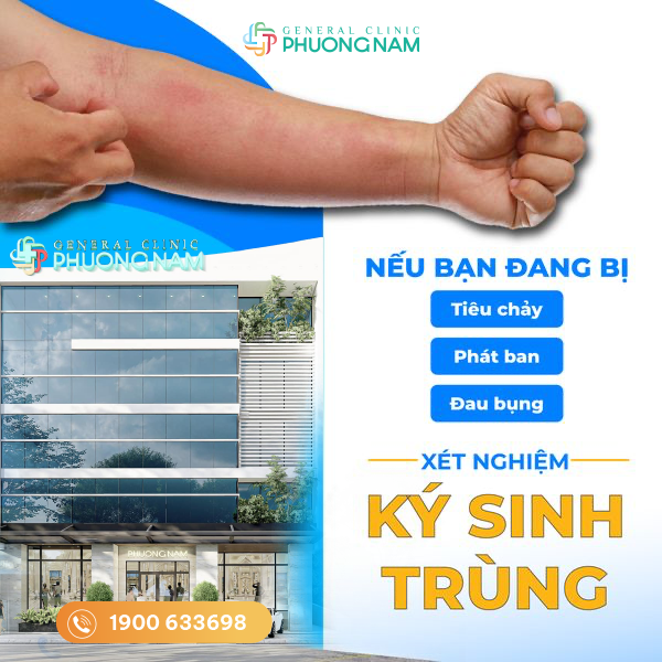 Xét Nghiệm Ký Sinh Trùng Đà Lạt – Quy Trình, Chi Phí & Địa Chỉ Uy Tín