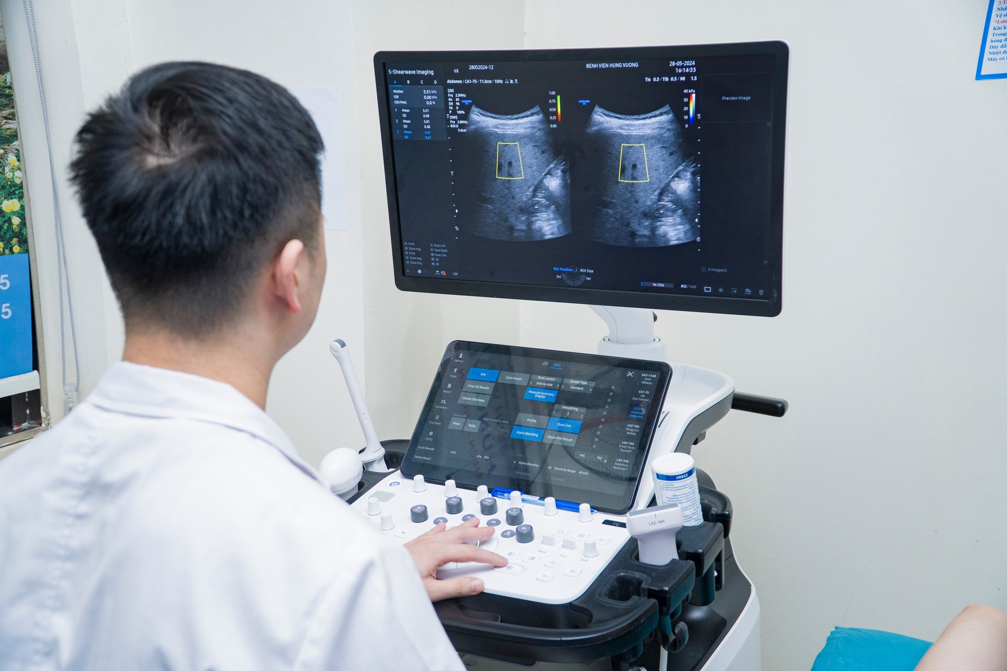 Siêu âm đàn hồi – Giải pháp phát hiện sớm xơ gan hiệu quả và an toàn