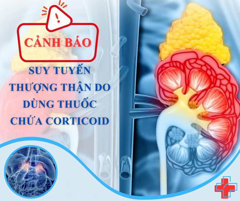 Cảnh Báo Suy Tuyến Thượng Thận Do Thuốc Xương Khớp Gia Truyền