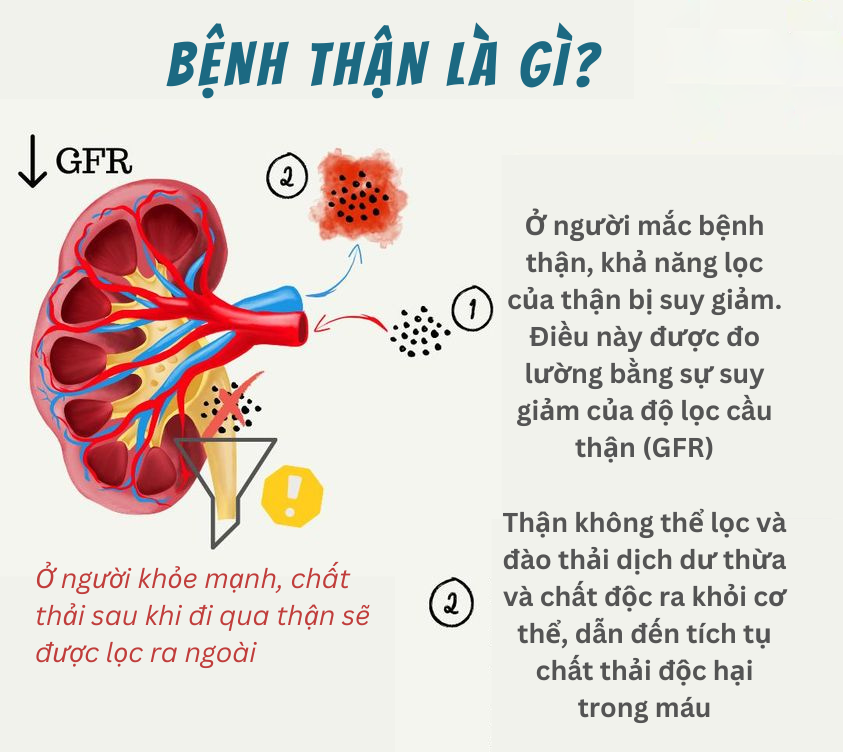 Bệnh về thận thường gặp: Nguyên nhân, triệu chứng và cách phòng ngừa hiệu quả