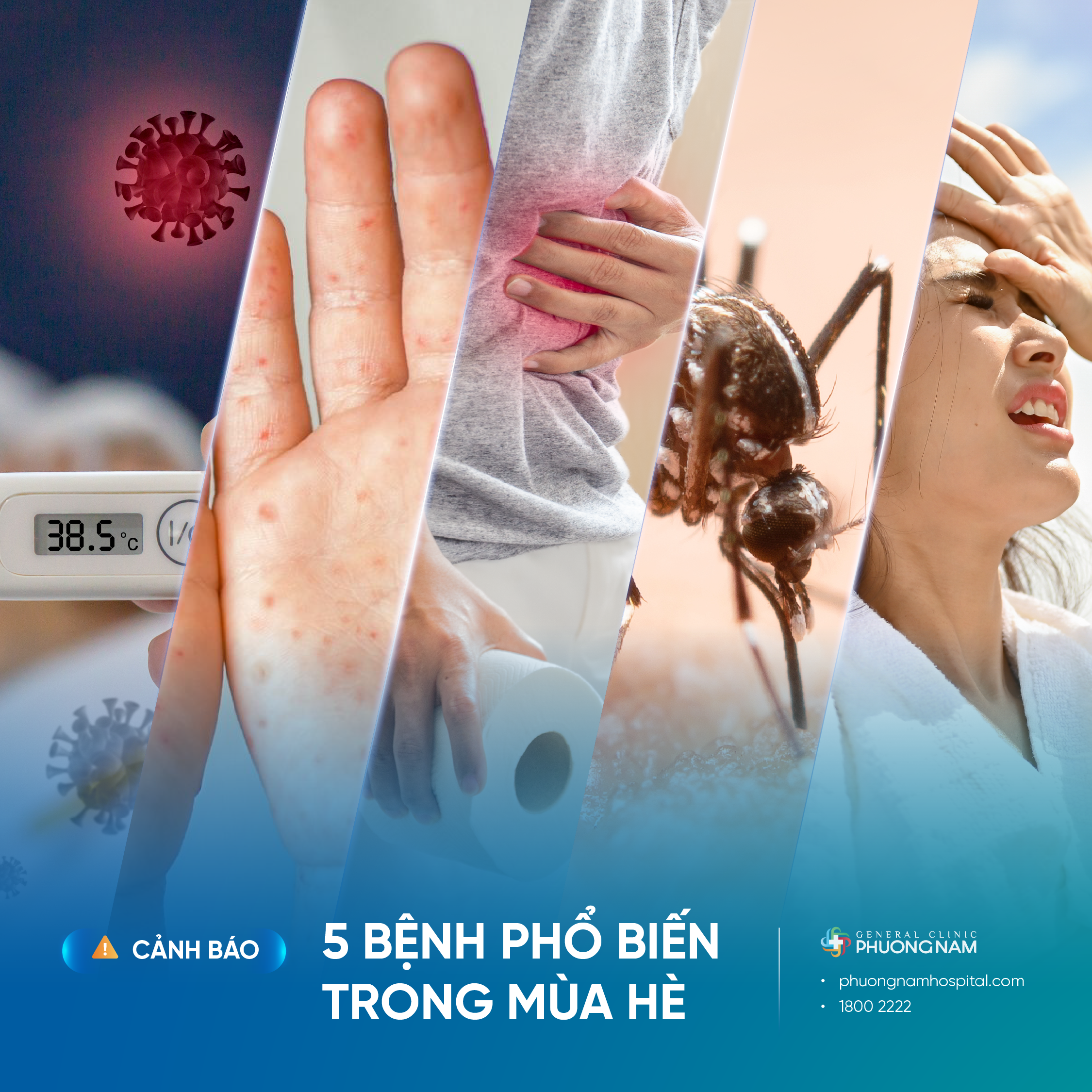 5 bệnh phổ biến mùa nắng nóng và cách phòng ngừa hiệu quả cho gia đình