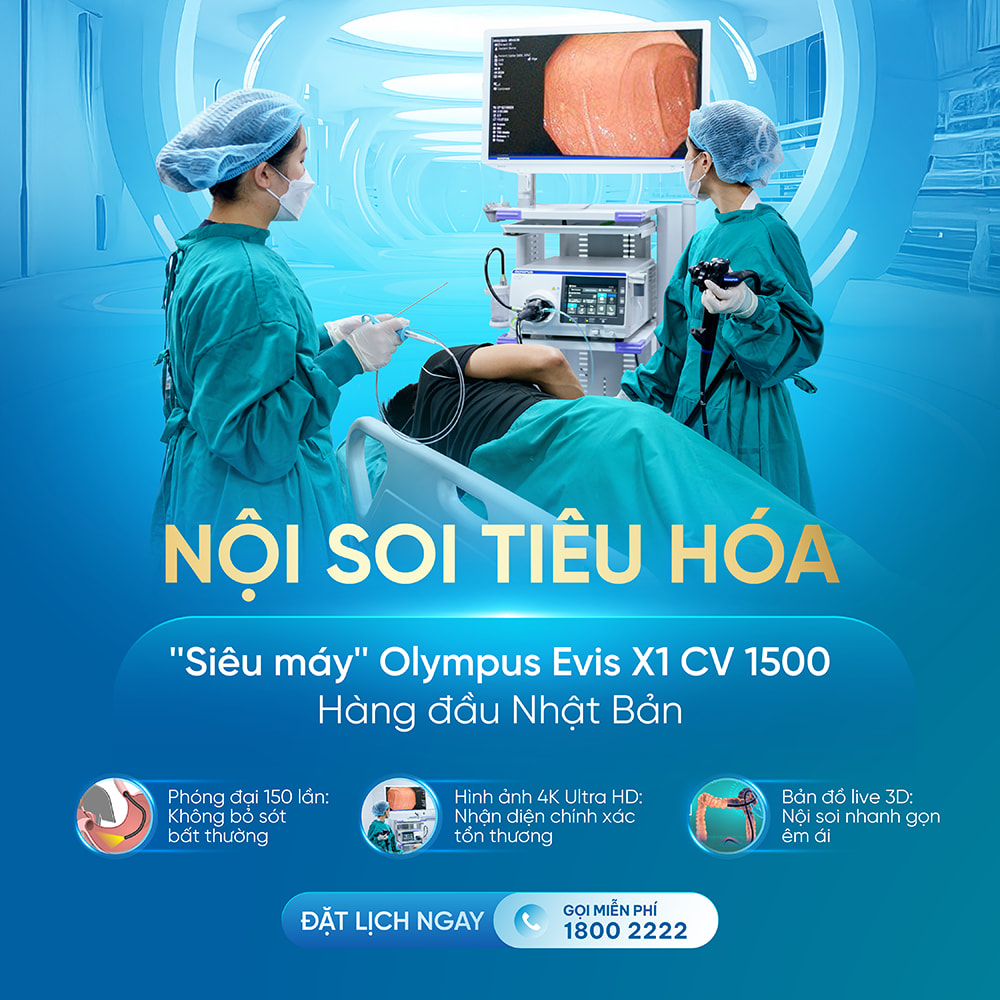Nội soi tiêu hóa không đau