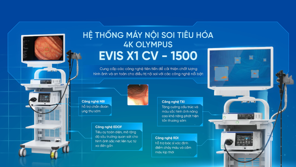 hệ thống máy nội soi Olympus EVIS X1 CV 1500
