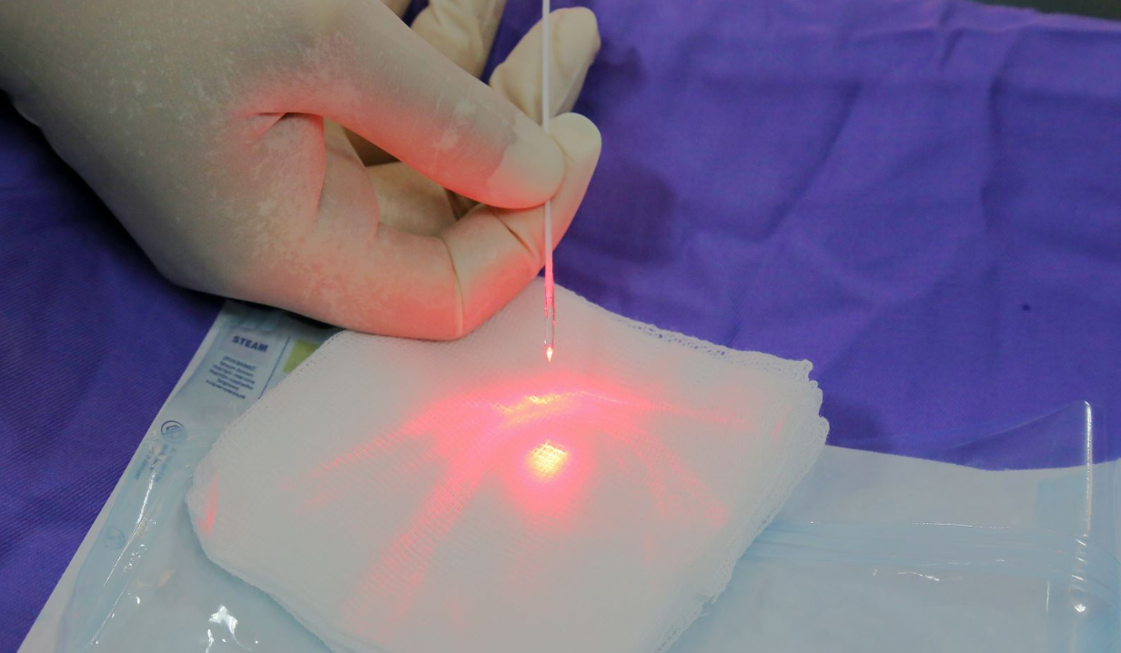 ĐỐT TRĨ BẰNG LASER DIODE TẠI PHƯƠNG NAM: GIẢI PHÁP ĐIỀU TRỊ KHÔNG ĐAU, KHÔNG CHẢY MÁU, HỒI PHỤC TỐI ƯU